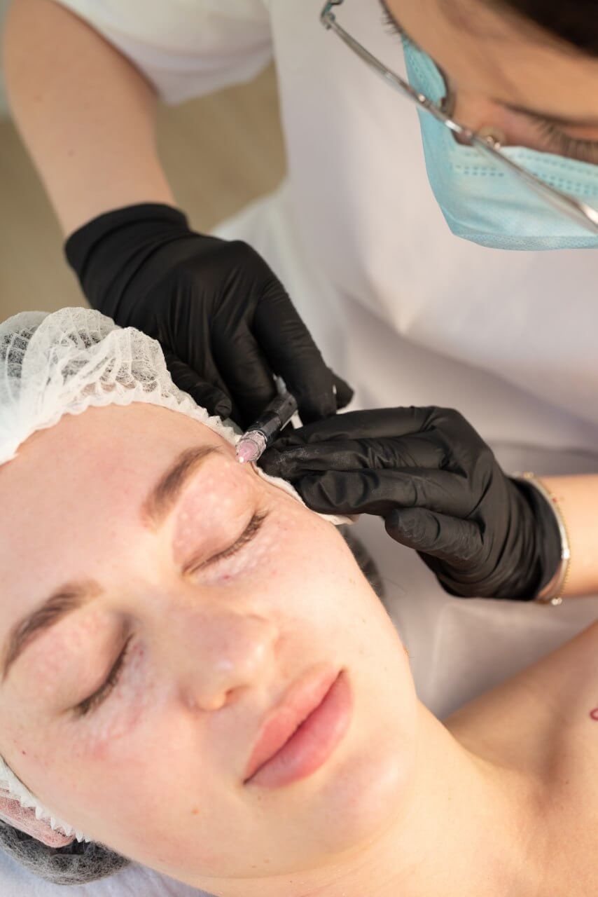 Mezoterapia igłowa okolicy oczu